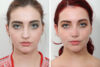 Rhinoplasty case #4046 slider thumbnail