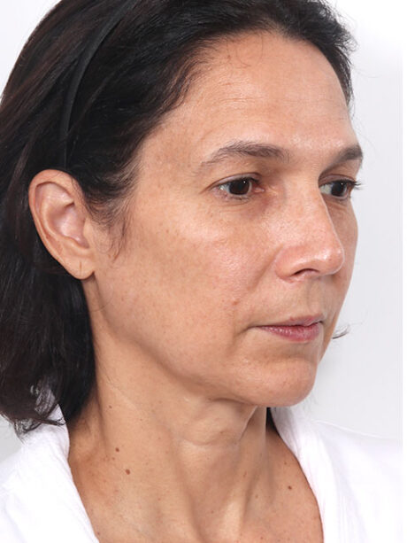 Celebrity Facial Plastic Surgeon In New York City | David Rosenberg, MD